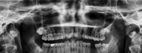 JMDENTAL SL: Atenci&oacute;n Odontol&oacute;gica de Calidad en Puente Genil