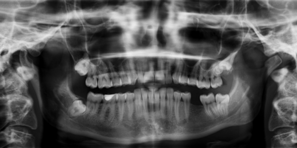 CLINICA DENTAL CARLODENT SL: Nueva clínica dental inicia operaciones en La Carlota