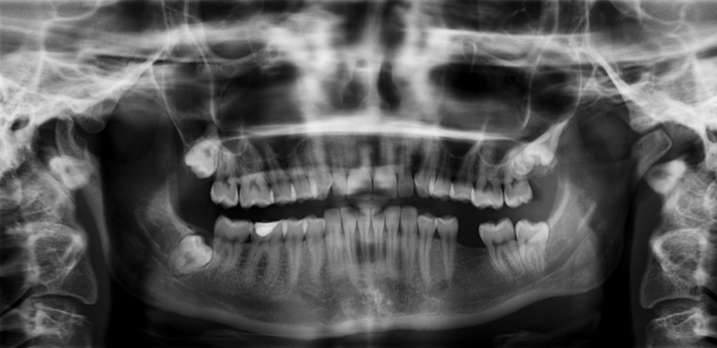 CLINICA DENTAL CARLODENT SL: Nueva clínica dental inicia operaciones en La Carlota