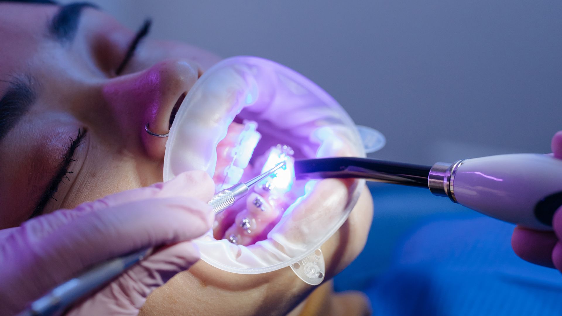 Innovación en Odontología: Nace DENTAL CAROSANZ S.L.